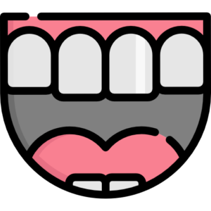 Veneers