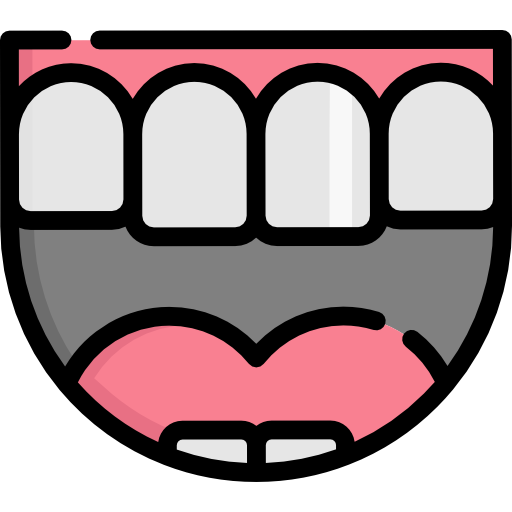 Veneers